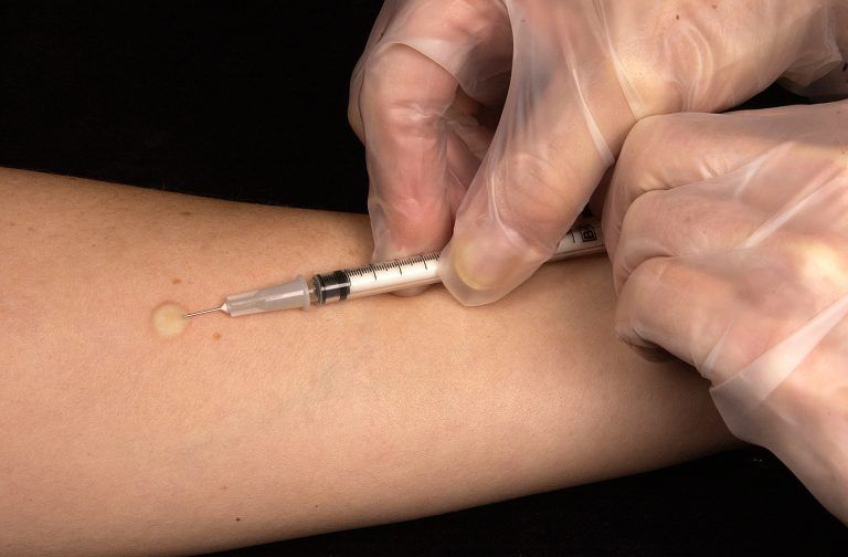 Nuevos métodos contra la tuberculosis